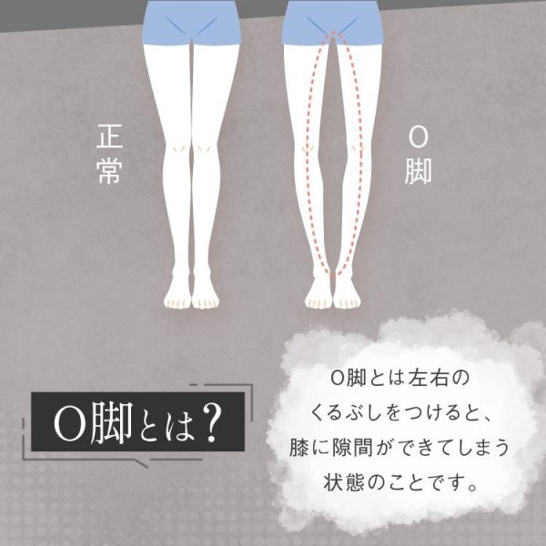 画像5: 【2024新商品】Ｏ脚改善防止計画 スパイラルレギンス (5)